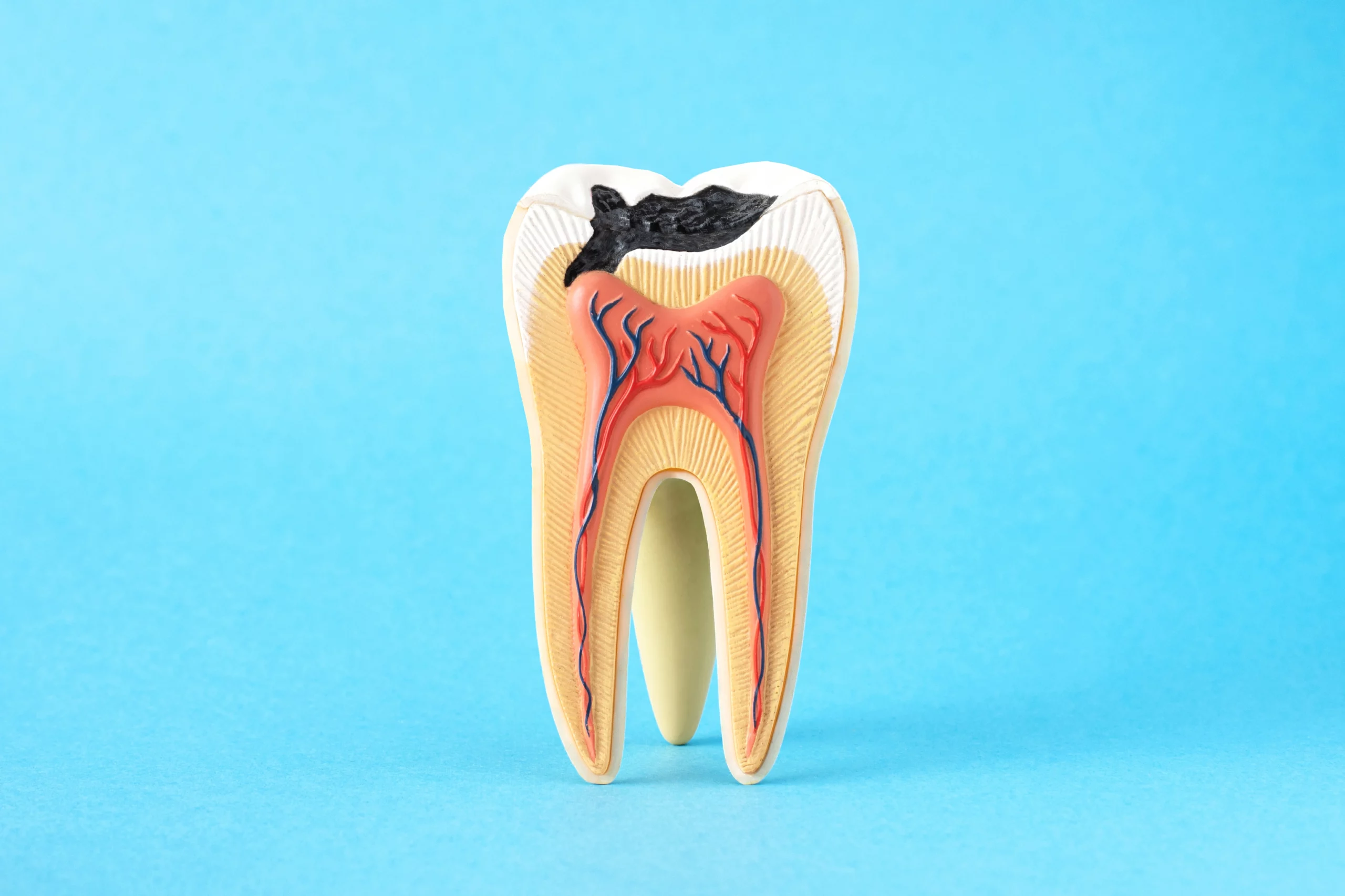 Image Prévention et soins - Dentiste cintegabelle